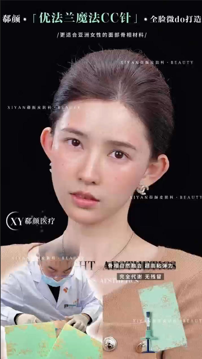 上海优法兰幼态骨相_沈亚鑫骨性支撑提拉案例